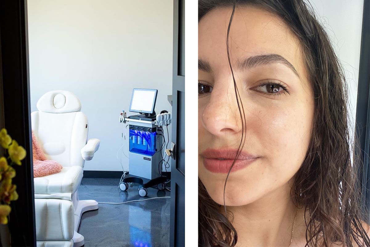 Hydrafacial review: Here's what happened to my skin after a Hydrafacial